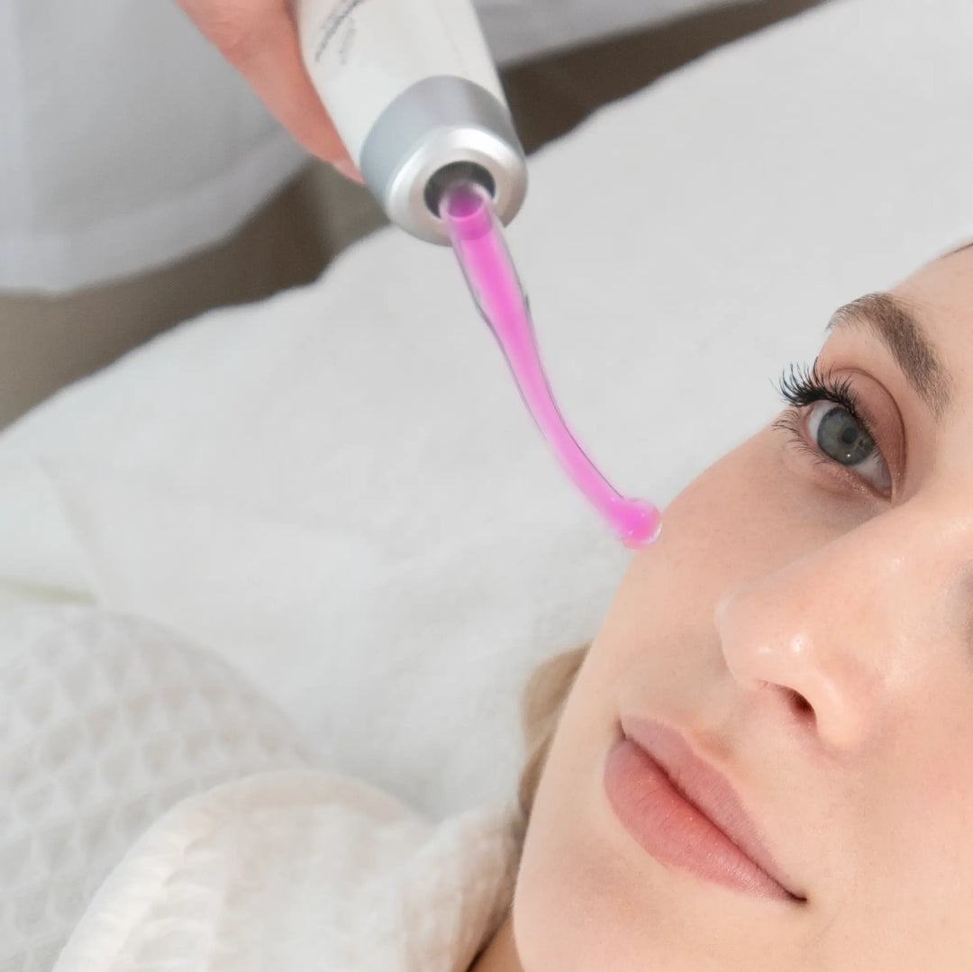 SkinNova Professional High-Frequency Skin System